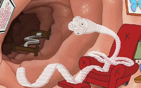 Un parassita si è sistemato nell'intestino